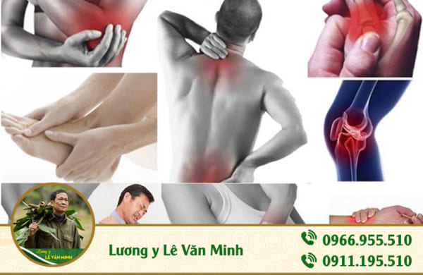 thuốc điều trị đau nhức xương khớp - Lương y Lê Văn Minh ảnh 1