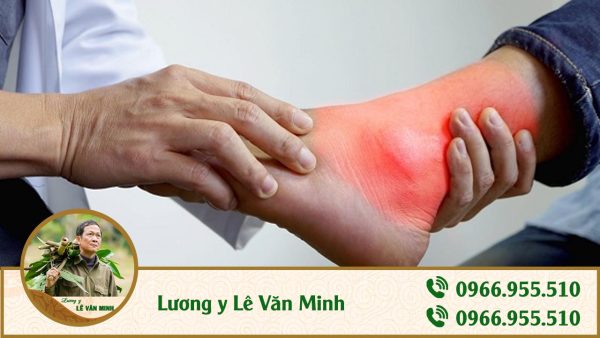 bệnh gout