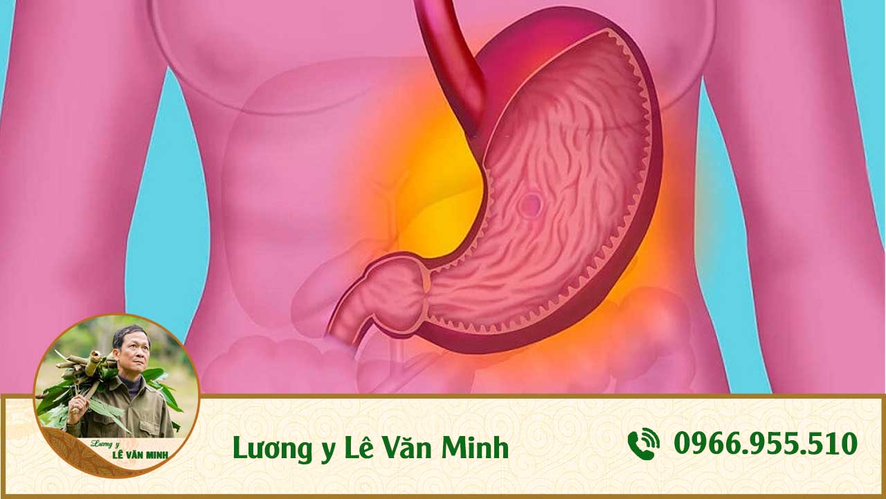 dạ dày